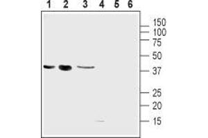 Western blot analysis of mouse muscle myoblast (C2C12), human brain glioblastoma (U-87 MG), human colorectal adenocarcinoma (HT-29) cell lines: - 1-3. (UCP2 Antikörper  (Intracellular))