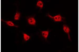 ABIN6274676 staining HeLa by IF/ICC. (BARD1 Antikörper  (Internal Region))
