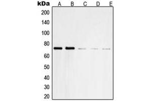 Western blot analysis of SHPTP2 expression in HeLa (A), Jurkat (B), NIH3T3 (C), U937 (D), A431 (E) whole cell lysates. (SHPTP2 (Center) Antikörper)
