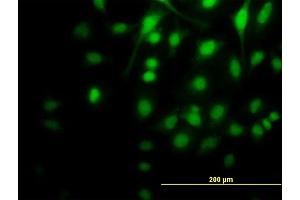 Immunofluorescence (IF) image for anti-Mitogen-Activated Protein Kinase Kinase 5 (MAP2K5) (AA 1-448) antibody (ABIN562429)