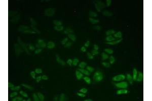 IHC-P analysis of Human HeLa cells, with FITC staining. (BLVRB Antikörper  (AA 2-206))