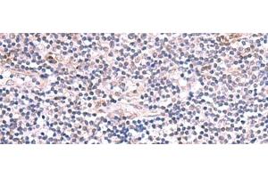 Immunohistochemistry of paraffin-embedded Human tonsil tissue using INPP5K Polyclonal Antibody at dilution of 1:85(x200) (INPP5K Antikörper)