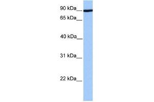 ADAM2 antibody used at 1 ug/ml to detect target protein.