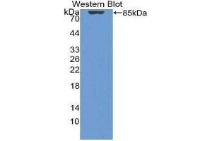 Western Blotting (WB) image for anti-Vitamin D-Binding Protein (GC) (AA 17-476) antibody (ABIN1980543)