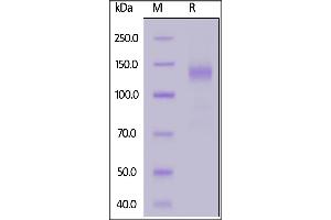 SARS-CoV-2 S1 protein, Fc Tag on  under reducing (R) condition. (SARS-CoV-2 Spike S1 Protein (B.1.1.7 - alpha) (Fc Tag))