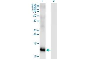 Western Blot analysis of MSRB2 expression in transfected 293T cell line by MSRB2 monoclonal antibody (M01), clone 2B7. (MSRB2 Antikörper  (AA 102-201))