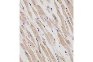 (ABIN6242408 and ABIN6577250) staining RANBP9 in human heart tissue sections by Immunohistochemistry (IHC-P - paraformaldehyde-fixed, paraffin-embedded sections). (Importin 9 Antikörper  (AA 1-388))