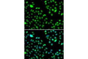 Immunofluorescence analysis of MCF-7 cells using L3MBTL3 antibody (ABIN5974391). (L3MBTL3 Antikörper)