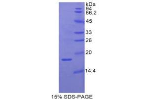 SDS-PAGE analysis of Pig RBP2 Protein. (RBP2 Protein)