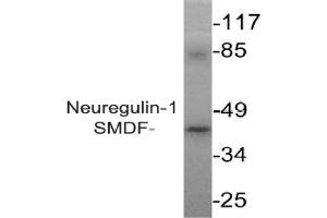 Image no. 2 for anti-Neuregulin 1 (NRG1) antibody (ABIN265466) (Neuregulin 1 Antikörper)