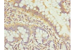 Immunohistochemistry of paraffin-embedded human small intestine tissue using ABIN7163882 at dilution of 1:100 (GALNT3 Antikörper  (AA 1-140))
