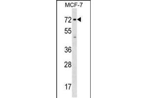 Western blot analysis in MCF-7 cell line lysates (35ug/lane). (Shugoshin Antikörper  (AA 339-367))