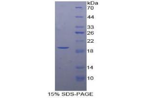 SDS-PAGE analysis of Cow Insulin Like Growth Factor Binding Protein 3 (IGFBP3) Protein. (IGFBP3 Protein)