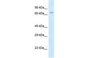 Image no. 1 for anti-Amyloid beta (A4) Precursor Protein-Binding, Family B, Member 2 (APBB2) (AA 63-112) antibody (ABIN6747341)