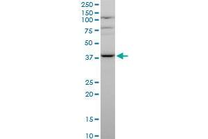 MVK polyclonal antibody (A01), Lot # 051116JC01.
