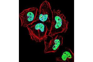 Immunofluorescence (IF) image for anti-Zinc Finger Protein 155 (ZNF155) antibody (ABIN2999111) (ZNF155 Antikörper)