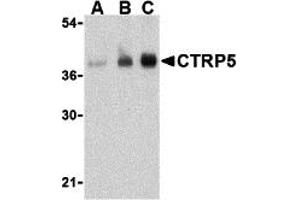 Western Blotting (WB) image for anti-C1q and Tumor Necrosis Factor Related Protein 5 (C1QTNF5) (N-Term) antibody (ABIN1031332) (CTRP5 Antikörper  (N-Term))