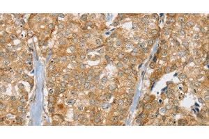 Immunohistochemistry (Paraffin-embedded Sections) (IHC (p)) image for anti-Solute Carrier Family 9 (Sodium/hydrogen Exchanger), Member 3 Regulator 2 (SLC9A3R2) antibody (ABIN7001497)