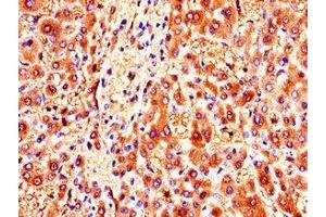 Immunohistochemistry of paraffin-embedded human liver tissue using ABIN7146178 at dilution of 1:100 (ZMPSTE24 Antikörper  (AA 217-347))