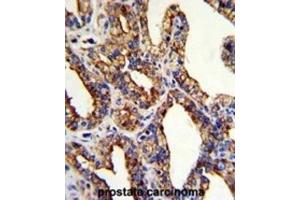 Immunohistochemistry (IHC) image for anti-Tumor-Associated Calcium Signal Transducer 2 (TACSTD2) antibody (ABIN3002746) (TACSTD2 Antikörper)