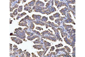 IHC analysis of Aconitase 2 using anti-Aconitase 2 antibody (ABIN7602770). (ACO2 Antikörper  (C-Term))
