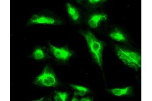 Image no. 3 for anti-Cancer/testis Antigen 1B (CTAG1B) antibody (ABIN1499904) (CTAG1B Antikörper)
