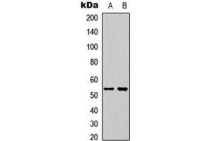 Western blot analysis of STEAP3 expression in HeLa (A), HepG2 (B) whole cell lysates. (STEAP3 Antikörper  (C-Term))