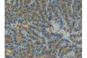 Immunohistochemistry (IHC) image for anti-Matrix Metallopeptidase 13 (Collagenase 3) (MMP13) (AA 103-290) antibody (ABIN7430978)