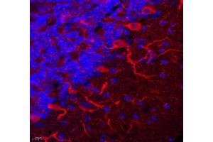 Immunofluorescent analysis of paraformaldehyde-fixed mouse brain using TRIM46 (ABIN7076020) at dilution of 1: 3200 (TRIM46 Antikörper)