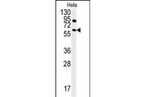 Western blot analysis of anti-ANTXR1 Antibody  (ABIN392154 and ABIN2841879) in Hela cell line lysates (35 μg/lane). (ANTXR1 Antikörper  (AA 358-386))