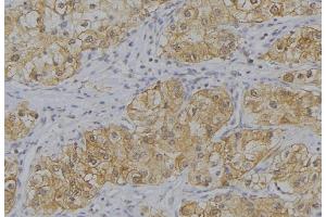 ABIN6273649 at 1/100 staining Human uterus tissue by IHC-P. (IL12B Antikörper  (C-Term))