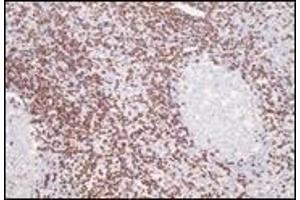 Immunohistochemistry (IHC) image for anti-CD8 (CD8) (C-Term) antibody (ABIN870515) (CD8 Antikörper  (C-Term))