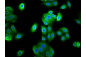 Immunofluorescence staining of HepG2 cells with ABIN7165566 at 1:133, counter-stained with DAPI. (FAM83D Antikörper  (AA 339-470))