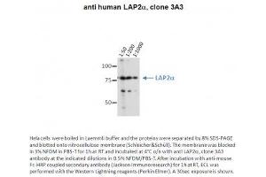 Image no. 1 for anti-Thymopoietin (TMPO) (AA 650-750) antibody (ABIN1042619) (Thymopoietin Antikörper  (AA 650-750))
