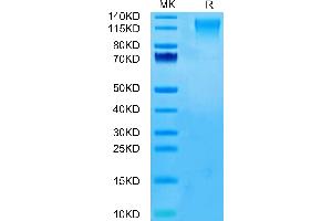 CD96 Protein (CD96) (AA 22-503) (His tag)