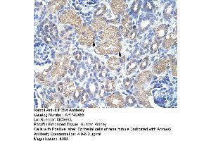Rabbit Anti-EIF3S4 Antibody  Paraffin Embedded Tissue: Human Kidney Cellular Data: Epithelial cells of renal tubule Antibody Concentration: 4. (EIF3G Antikörper  (N-Term))