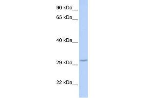 WB Suggested Anti-FBXO27 Antibody Titration: 0. (FBXO27 Antikörper  (Middle Region))