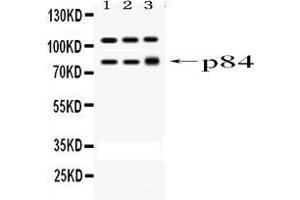 Western blot analysis of STAT1 using anti-STAT1 antibody .