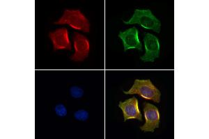 ABIN7094518 and ABIN7098567 staining HepG2 cells by IF/ICC. (TIGAR Antikörper  (Internal Region))