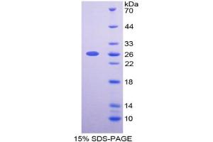Image no. 1 for Basigin (Ok Blood Group) (BSG) (AA 79-280) protein (T7 tag,His tag) (ABIN6236758)