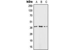 Western blot analysis of GPR81 expression in HEK293T (A), Raw264. (GPR81 Antikörper  (C-Term))