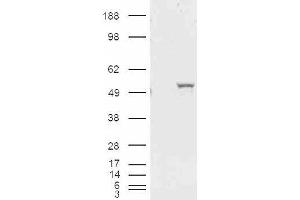 HEK293 overexpressing ALDH1A1 and probed with ABIN185587 (mock transfection in first lane). (ALDH1A1 Antikörper  (Internal Region))