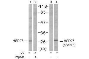Image no. 1 for anti-Heat Shock 27kDa Protein 1 (HSPB1) (pSer78) antibody (ABIN197002) (HSP27 Antikörper  (pSer78))