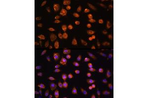 Immunofluorescence (IF) image for anti-Fms-Related Tyrosine Kinase 4 (FLT4) (AA 1174-1363) antibody (ABIN6140699)