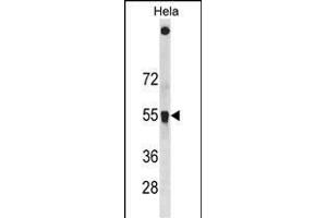 SQSTM1 Antibody (C-term ) (ABIN1881829 and ABIN2838612) western blot analysis in Hela cell line lysates (35 μg/lane). (SQSTM1 Antikörper  (C-Term))