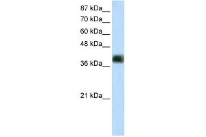 WB Suggested Anti-ZNF435 Antibody Titration:  2. (ZSCAN16 Antikörper  (Middle Region))