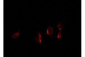 Immunofluorescence (fixed cells) (IF/ICC) image for anti-Estrogen Receptor 1 (ESR1) (pSer118) antibody (ABIN6254948)