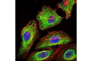 Immunofluorescence analysis of HeLa cells using GPC3 mouse mAb (green). (Glypican 3 Antikörper)