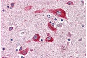 Anti-ENTPD2 antibody  ABIN1048566 IHC staining of human brain, cortex. (ENTPD2 Antikörper  (Internal Region))