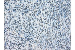 Image no. 11 for anti-P450 (Cytochrome) Oxidoreductase (POR) antibody (ABIN1497743) (POR Antikörper)